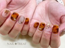 ネイルトリート 茨木駅前店(NAIL TREAT)/べっ甲ネイル