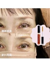 ピピラッシュ(pipi lash)/BKキープセラムでもちアップ◎