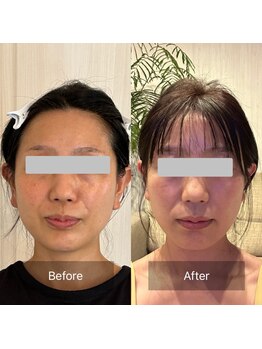 ククナ(Kukuna)/-５歳若見え！理想の小顔へ！