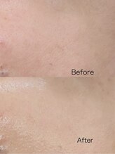 エクラ(eclat)/人気NO!ララピール