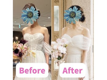 ボディキュア ブライダル美容整体 大阪梅田/デコルテで差をつける★/北新地