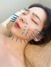 ★【小顔美容鍼】リフトアップ/小顔/浮腫み解消♪(60分)11,000円→7,500円
