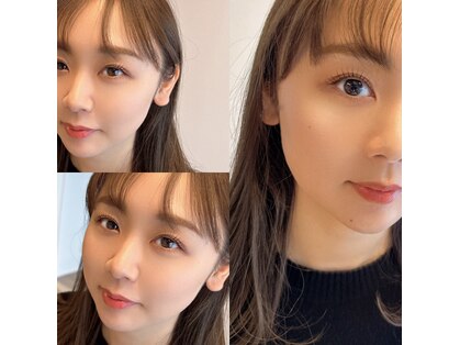 アイラッシュルーム ニノン(Eyelash room Ninon)の写真