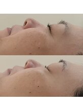 リラ(Lilas)/Lilasならではの組み合わせ