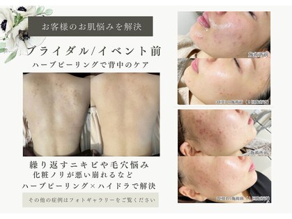 ハル(Halu)の写真