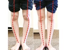 エール シガ(AILE SHIGA)