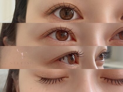 セルフィッシュ(SELFISH)の写真