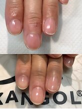 カンゴールサロン 郡山ノース(KANGOL SALON)