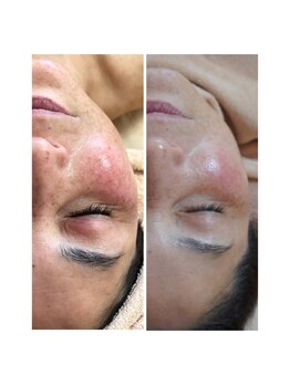 リバージュ(Riverge)/