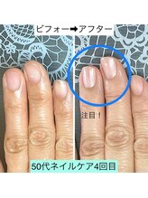 桃の木 吉祥寺店/自爪育成で爪は大きくなります