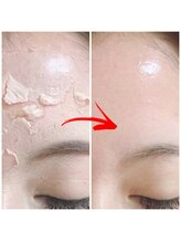 パルファム/最短で肌質改善ハーブピーリング