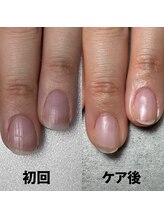 ココ(COCO)/薄かったお爪