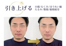 オーラリッチ(ORARICH)