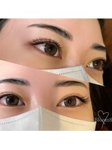 ブルームエイト(Bloom8)/