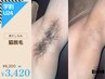 【学割U24】わき脱毛￥3,200→￥2,880