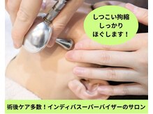 インディバ ミマリ(INDIBA ミマリ)