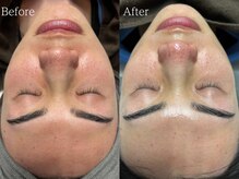 ルミナ シブヤ(LUMINA SHIBUYA)/【ダクトピール】1回目　正面