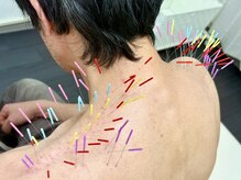 とだ鍼灸院/《鍼灸施術》首肩レスキュー鍼灸