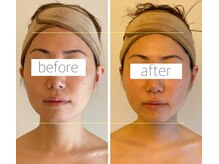 パル コルギサロン(Pal. Korugi salon)/コルギビフォーアフター