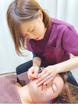 葵はりきゅう整骨院の写真/鍼灸で血行を促進することで健康的な体に◎丁寧なカウンセリングでお悩みの原因を徹底追及し根本から改善！