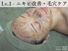 【学割U24】剥離ありハーブピーリング[剥離なし約10回分の効果]