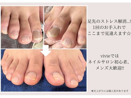 ビビィ(vivie)の写真
