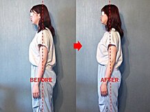アトラス/初回のお客様のBefore＆after