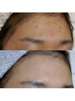 ザ シー タイムレスビューティ(THE SHE)/20代お客様症例写真