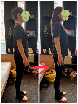 はあと/巻き肩改善