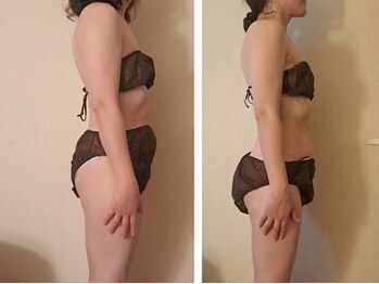 マナ(mana)/1か月での変化☆