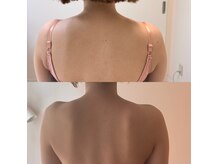 プレジール(Plaisir)の雰囲気（定期的にメンテナンスでスッキリ背中へ）