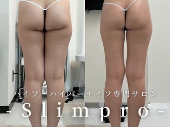 スリムプロ/美脚コース