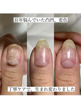 フェミニンネイル(Feminine Nail)/