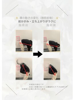 nのレシピ みんなの整体院/腰痛/前かがみ・反る動きの変化