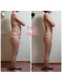 リセル(Re-Cell)の写真/感動オールハンド★年明けの緩んだ体のラインを引き締め!究極ボディメイクで最強デトックス&エイジングケア