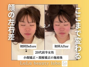 ルルラボ(LuLu beauty labo)/歪みを正して左右対称の美顔へ
