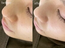 テオリア(TEORIA)/