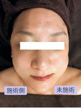 ボディーワークスナビ(Body Works Navi)/50代★顎のズレ＆脂肪蓄積