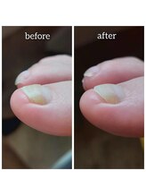 爪切り屋 足楽/