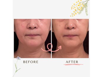 モナージュ(Monaju)