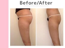 キングスサロン 神戸ハーバーランド店/Before / After