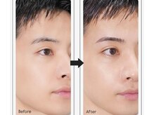 ルポ 札幌円山店(repos)/メンズ美眉HBL