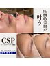【顔wax脱毛】CSPフェイシャル