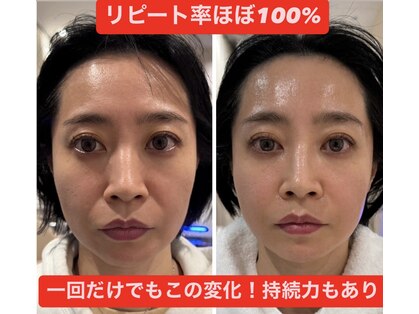 フェムプリュ(femplus)の写真