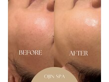 オージン スパ(OJIN SPA)の雰囲気（【ララピール/イロン】肌質改善◆肌管理◆ツヤ肌◆水光肌）