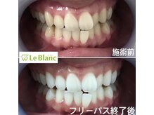 ルブラン 奈良店(Le Blanc)/コンプレックスを無くす！