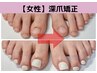 爪の形を変える【美爪育成再生】女性フット