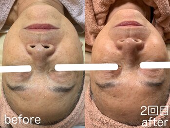 ハレオラ(HaleOla)/60代 素肌を育てる1stSTEP2回目