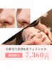 【期間限定】光フェイシャル＋小鼻毛穴洗浄＋小鼻コラーゲンシート