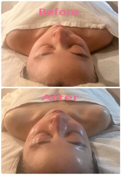 ラネージュ(LA NEIGE)/【札幌LA NEIGE】毛穴/引き締め